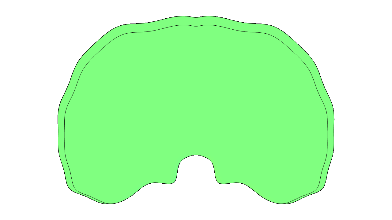 Tissue scale brain injury modeling and translation
